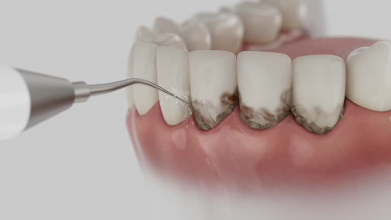 Reliable Tooth Extraction contractor in Gillespie County County, TX by Dentist Open Now